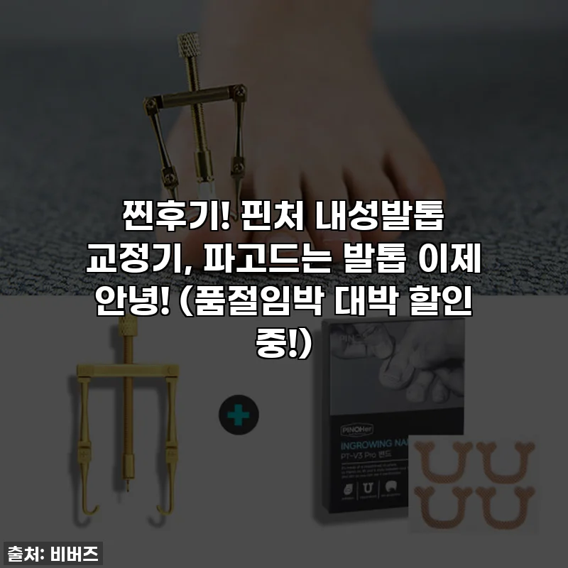 찐후기! 핀처 내성발톱 교정기, 파고드는 발톱 이제 안녕! (품절임박 대박 할인 중!)