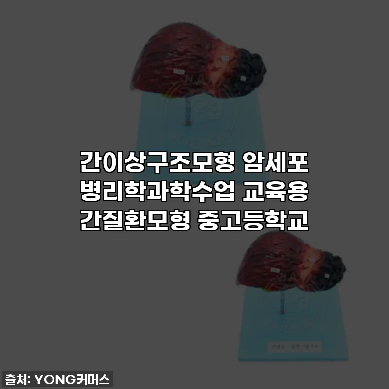 간이상구조모형 암세포 병리학과학수업 교육용 간질환모형 중고등학교