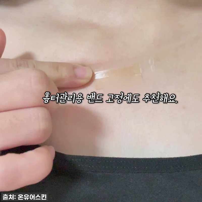 실리픽스롤 실리콘 반창고, 이건 무조 관련 이미지 10
