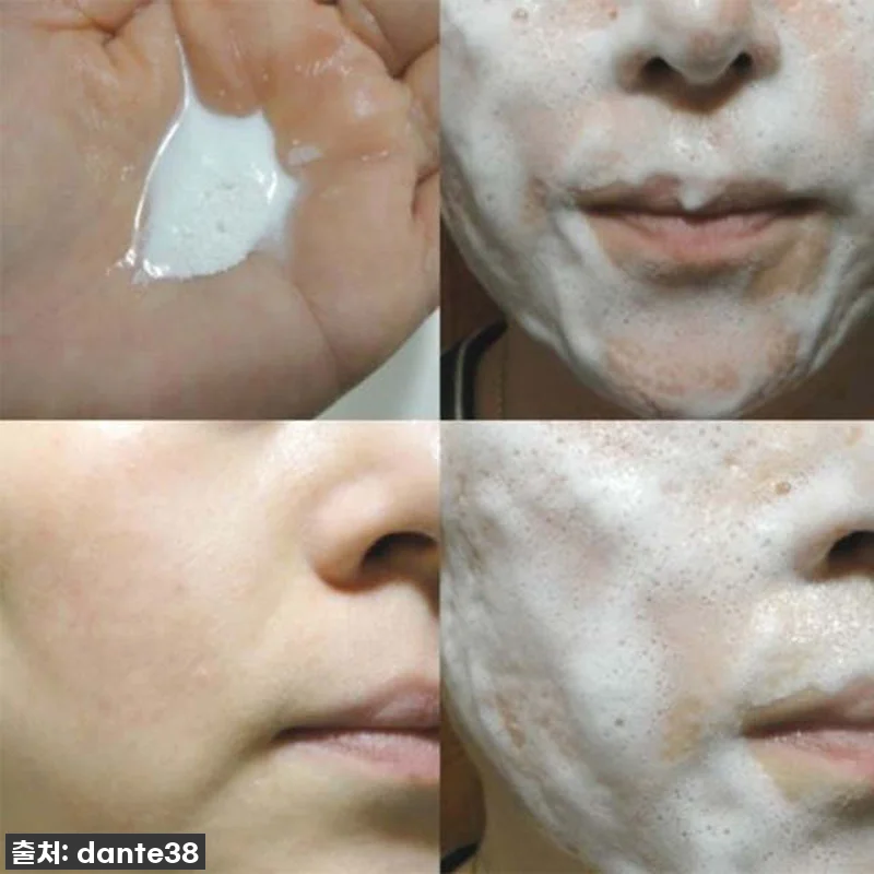 인생템 등극! 칙칙한 피부 이제 안녕 관련 이미지 2