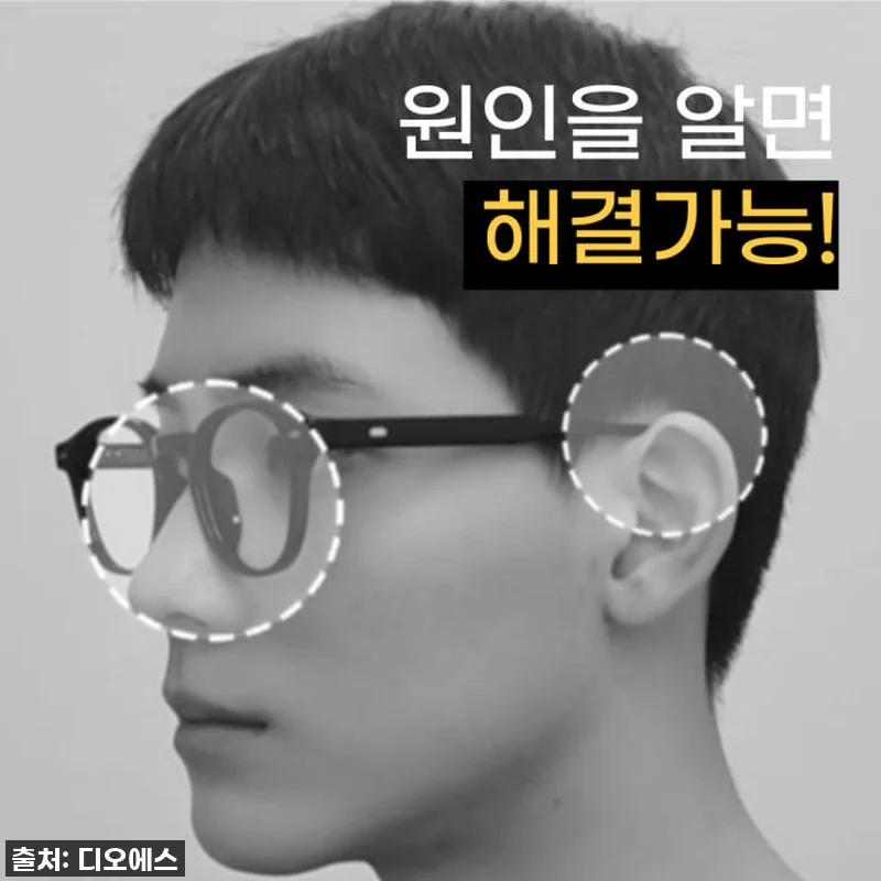 안경 흘러내림 이제 그만! 찐후기: 관련 이미지 2