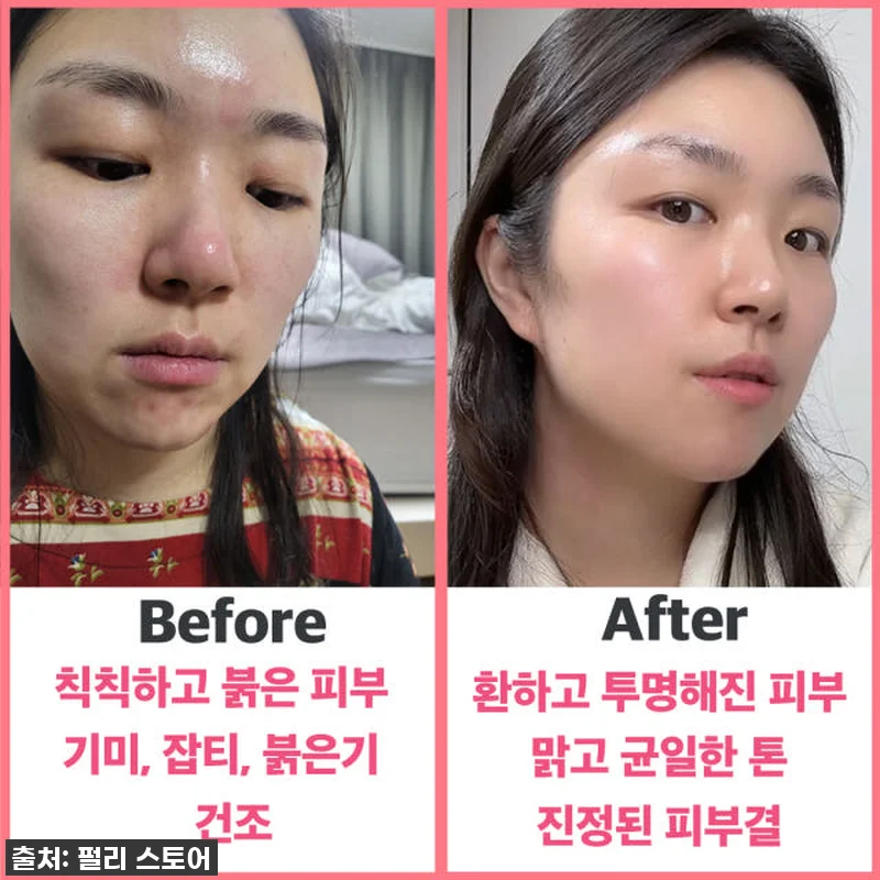 펄리 엑소좀 미백 모공 앰플과 시카 관련 이미지 2