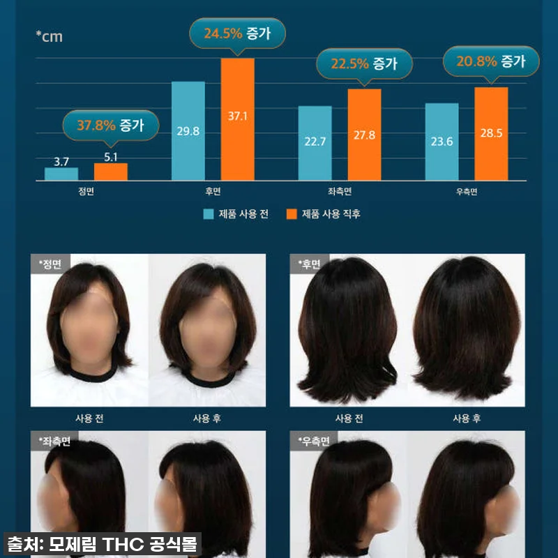 환절기 두피 비상? 모제림 엘릭서 샴 관련 이미지 5
