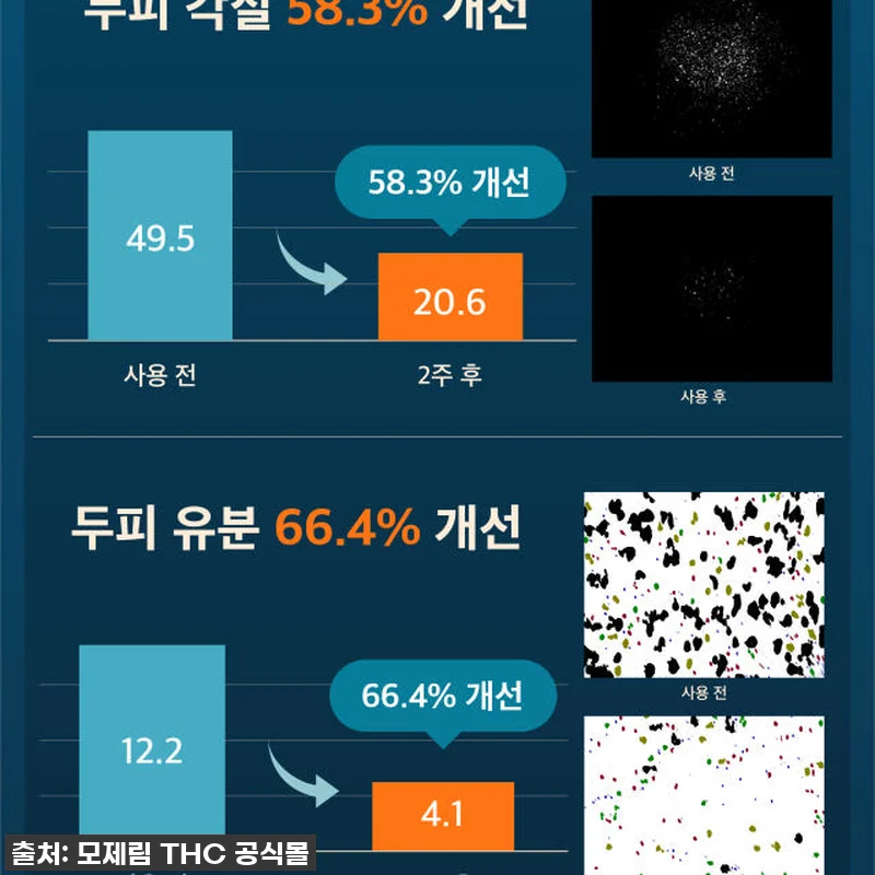 환절기 두피 비상? 모제림 엘릭서 샴 관련 이미지 6