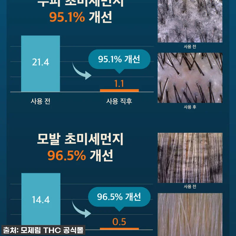 환절기 두피 비상? 모제림 엘릭서 샴 관련 이미지 7