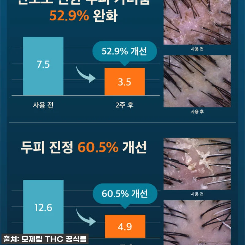 환절기 두피 비상? 모제림 엘릭서 샴 관련 이미지 8