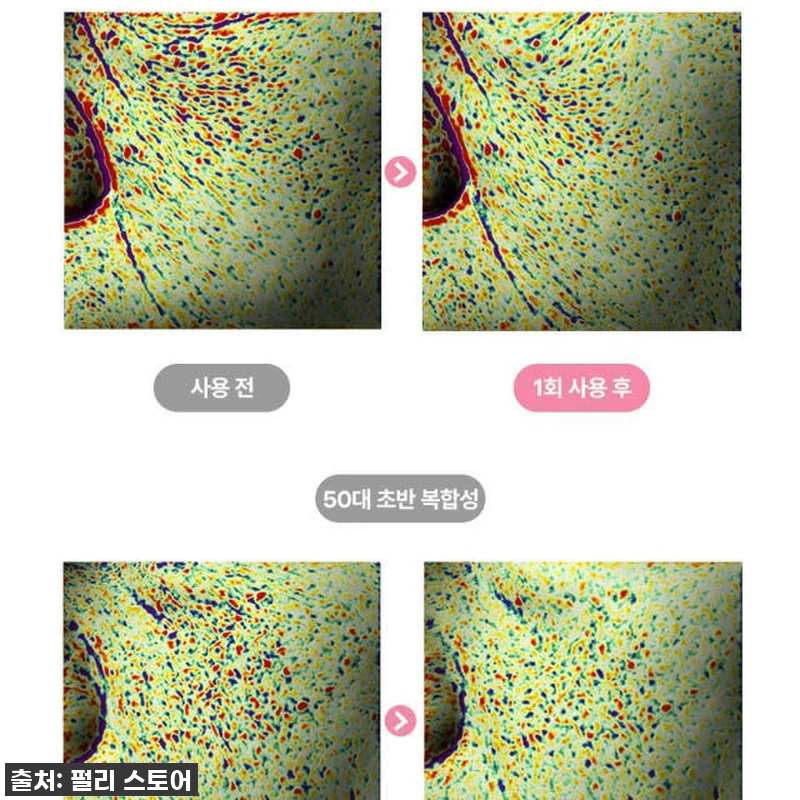 펄리 엑소좀 미백 모공 앰플과 시카 관련 이미지 7
