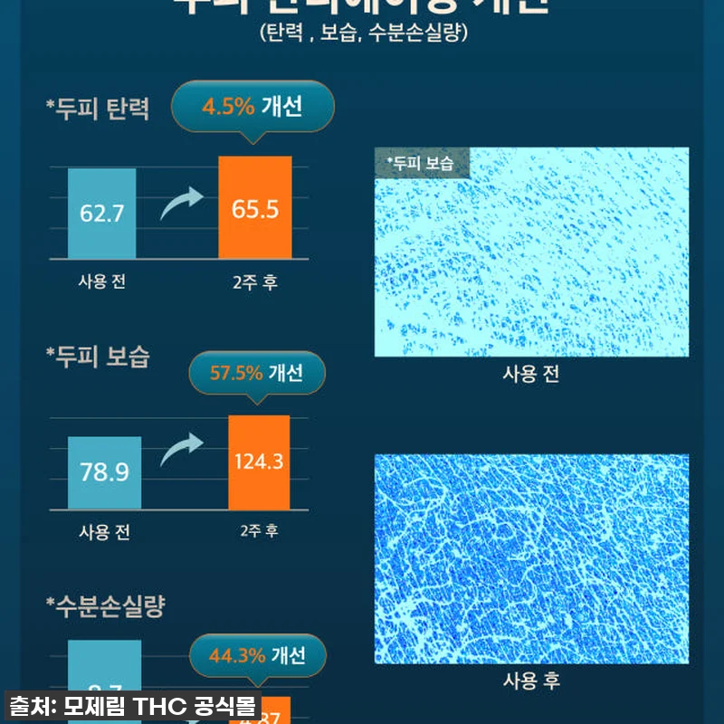 환절기 두피 비상? 모제림 엘릭서 샴 관련 이미지 9