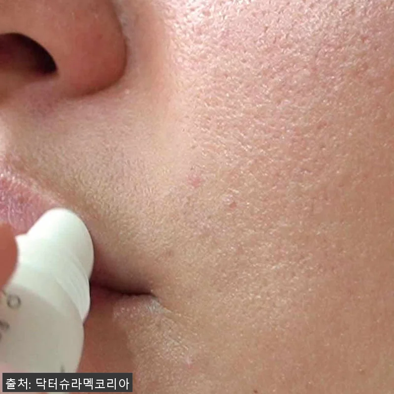 닥터슈라멕 소프트 립 밤 사용후기: 관련 이미지 3