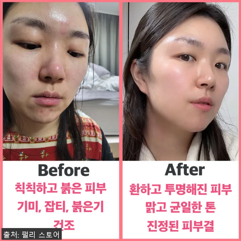 펄리 모공 탄력 히알루론산 미백 시카 관련 이미지 3