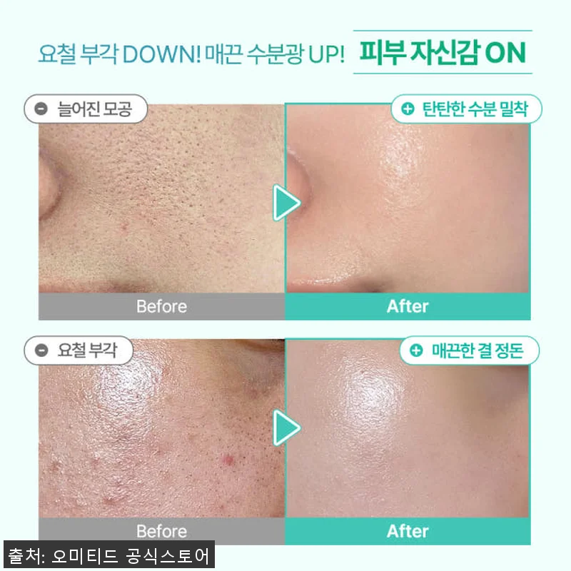 오미티드 민감성 피부 진정 LHA 결 관련 이미지 5