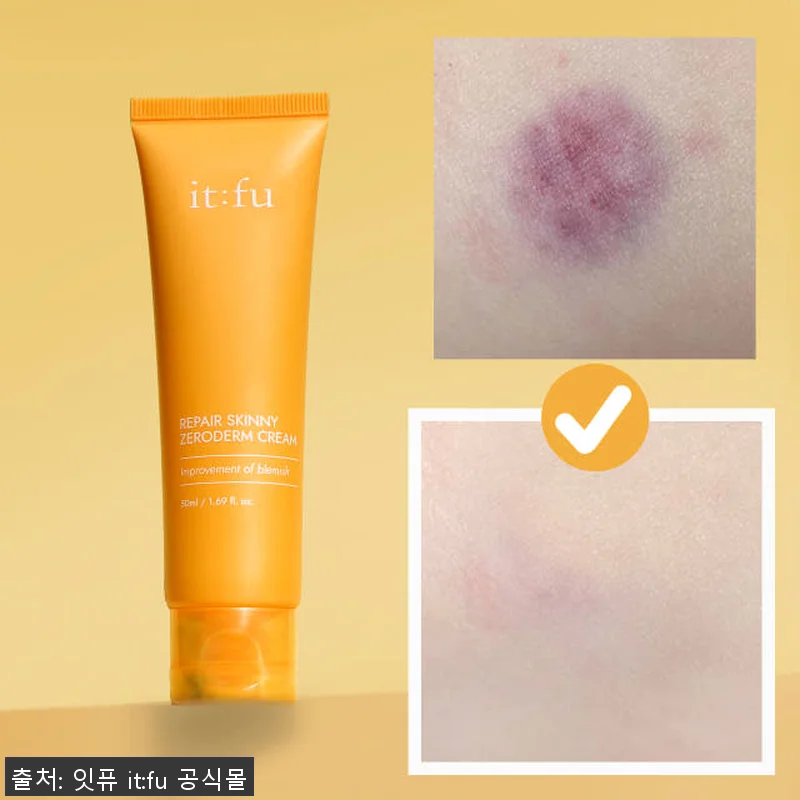 제로덤 크림 착색 흔적 지우개 사용후 관련 이미지 7