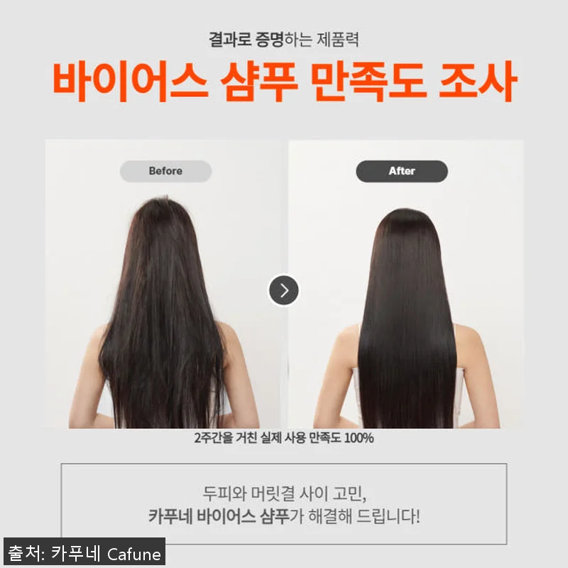 카푸네 바이어스 민감성 두피 샴푸 5 관련 이미지 8