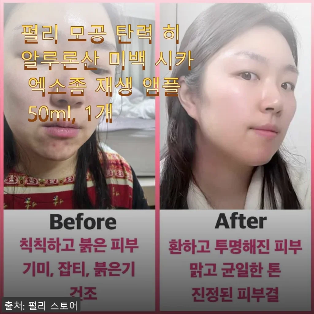 펄리 모공 탄력 히알루론산 미백 시카 엑소좀 재생 앰플 사용 후기