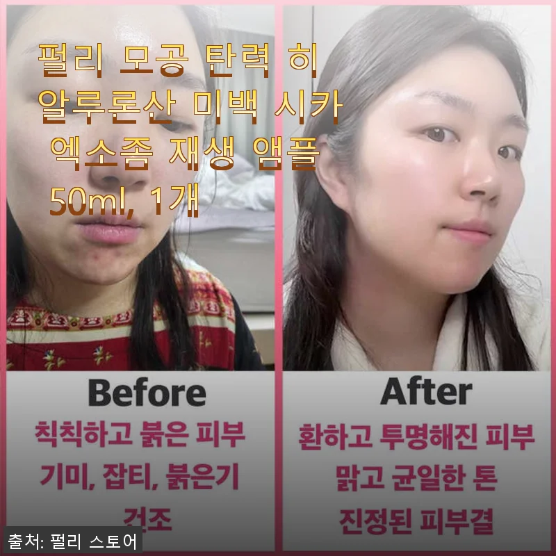 펄리 모공 탄력 히알루론산 미백 시카 엑소좀 재생 앰플 사용 후기